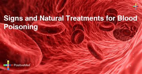 The patient, who is not being identified, has now recovered after having the toothpick removed. Signs and Natural Treatments for Blood Poisoning - PositiveMed