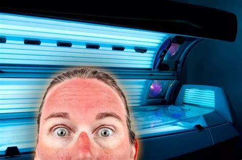 The Risks Of Tanning Beds Optometrists Insights