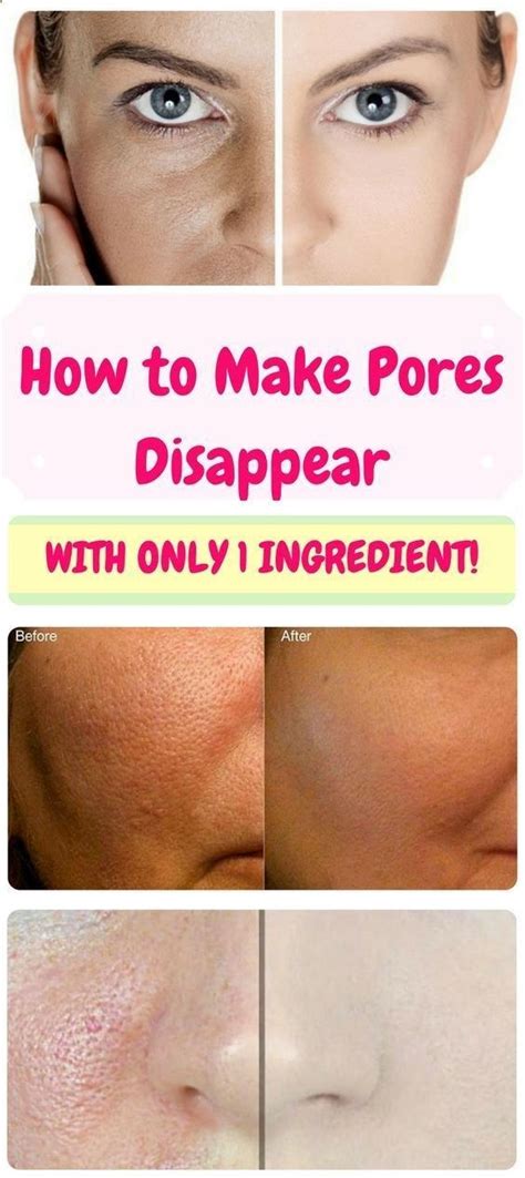 How To Make Pores Disappear With Only 1 Ingredient Home Beauty Tips Pore Smaller Pores