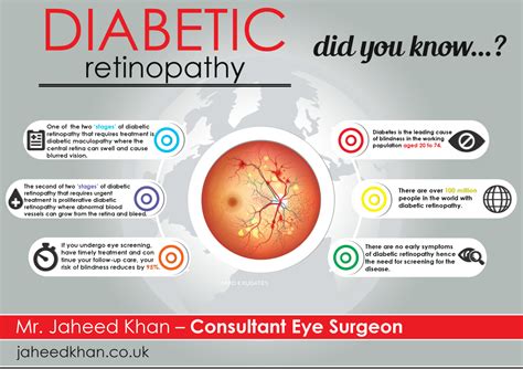 Diabetic Retinopathy Did You Know Jaheed Khan