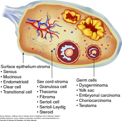 Ovarian Germ Cell And Sex Cord Stromal Tumors Williams Gynecology 3e