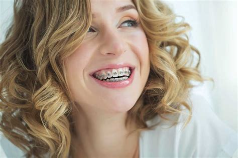 Treatments For Adults Edmonton Orthodontist Level Orthodontics