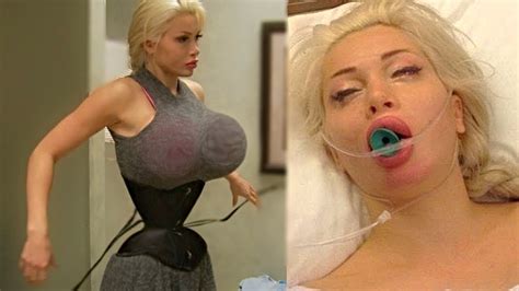 People Who Took Their Plastic Surgery Too Far Youtube