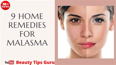 How To Cure Melasma From The Inside Naturally This Is A Common Skin