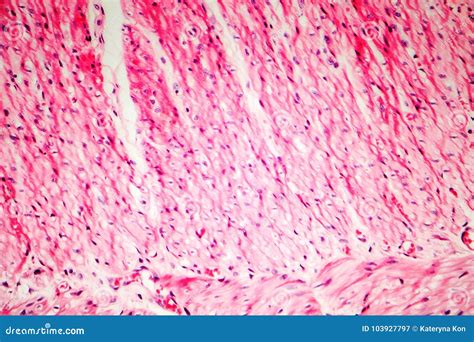 Human Smooth Muscle Stock Image Image Of Muscle Photomicrograph