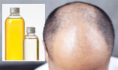 Hair Loss Treatment The Best Oils Shown To Promote Hair Growth Backed By Evidence Uk