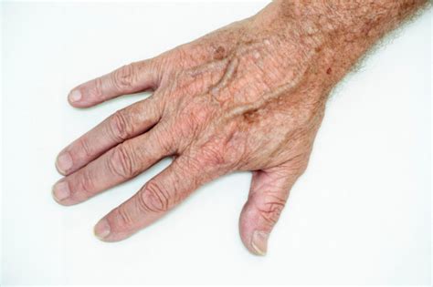 Hand With Age Spots Stock Photo Download Image Now Istock