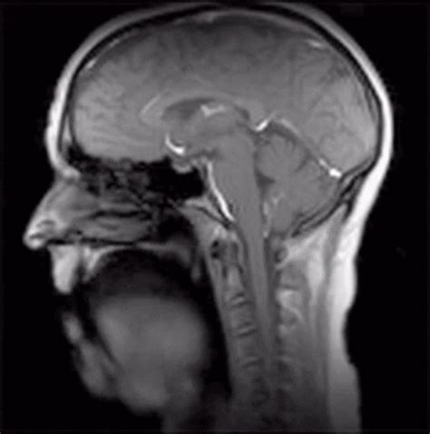 Dynamic Mri GIF Find Share On GIPHY