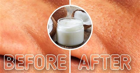 Dermatologists Share The Worst Skin Care Advice Theyve Ever Heard