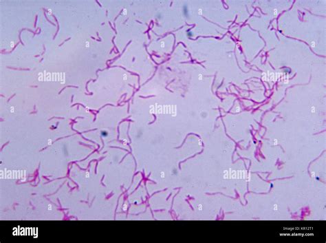 This Photomicrograph Shows Fusobacterium Nucleatum After Being Cultured