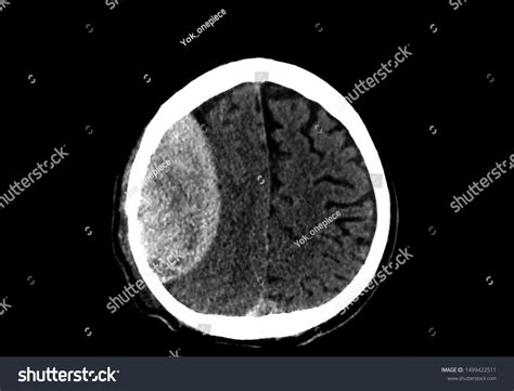 Axial View Computer Tomography Ct Scan Stock Photo 1499422511