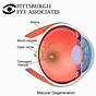 Eye Chart For Macular Degeneration