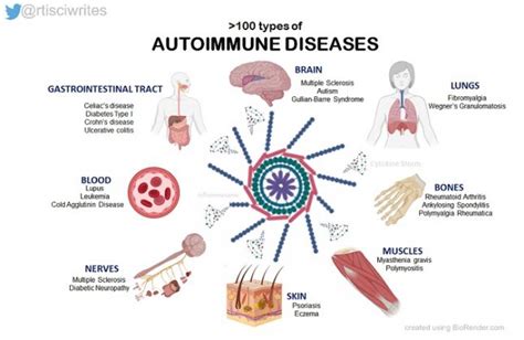 Autoimmune Diseases When Your Defense System Revolts Biovoicenews