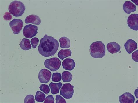 Plasmacytoid Lymphocyte 3 Era