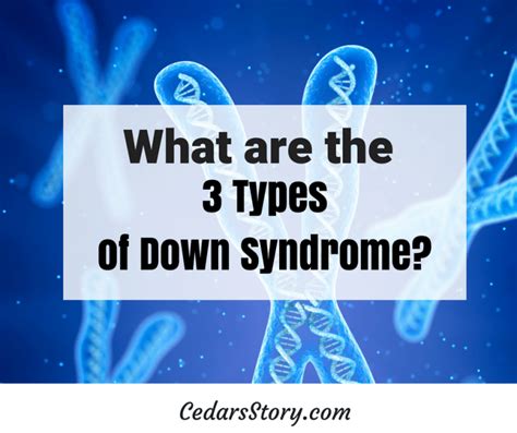 3 types of down syndrome cedars story