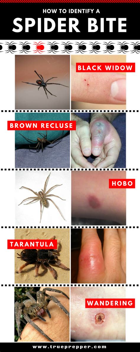 How To Identify Black Widow Spider Bite How To Identify A Poisonous