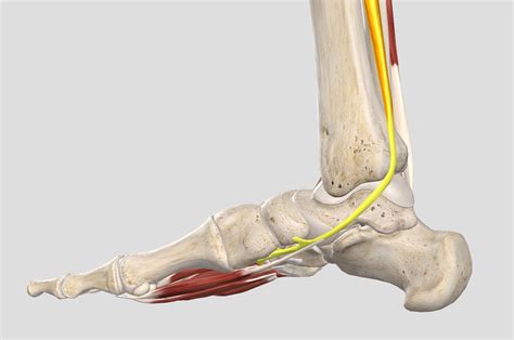 Posterior Tibial Tendon Dysfunction Foot Ankle Specialists In Kelso Tweed Podiatry