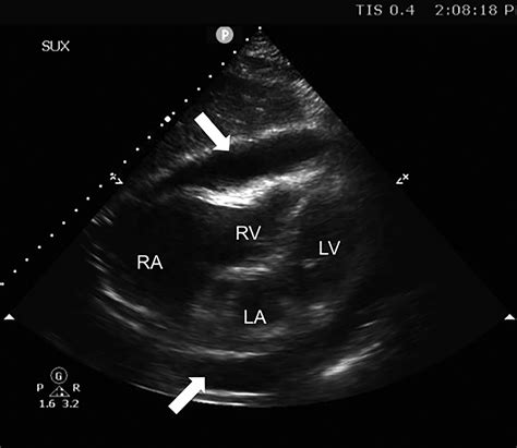 New Concepts Of Ultrasound In The Emergency Department Focused