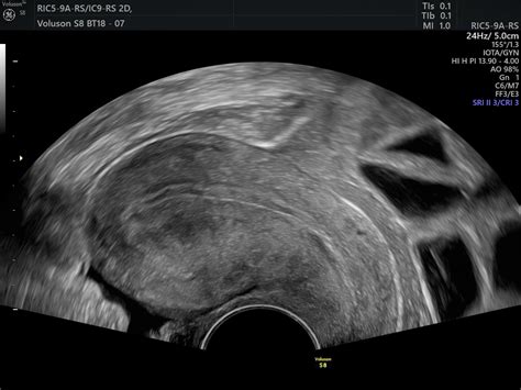 Gynaecological Pelvic Scan Private One On One Pregnancy And Fertility