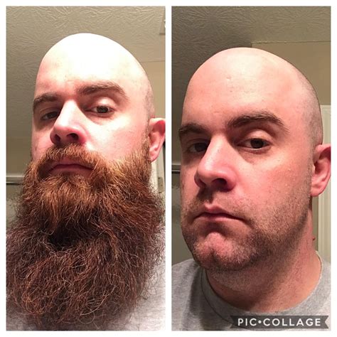 before and after i had to shave my beard off for a new job i was not happy shaved head with