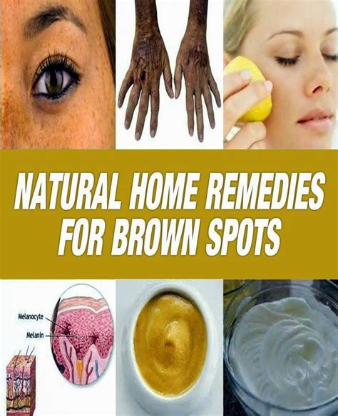Natural Home Remedies For Brown Spots Medi Tricks