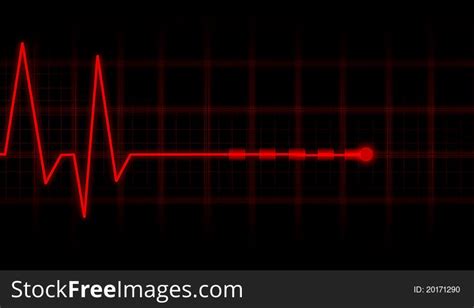 Ecg Electrocardiogram Free Stock Photos Stockfreeimages
