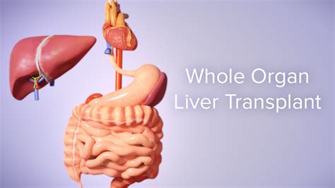Liver Transplant Cincinnati Childrens Youtube