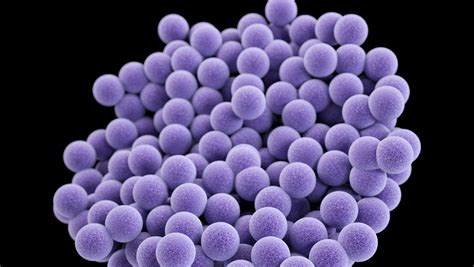 Mrsa Infections Remain A Back To School Risk