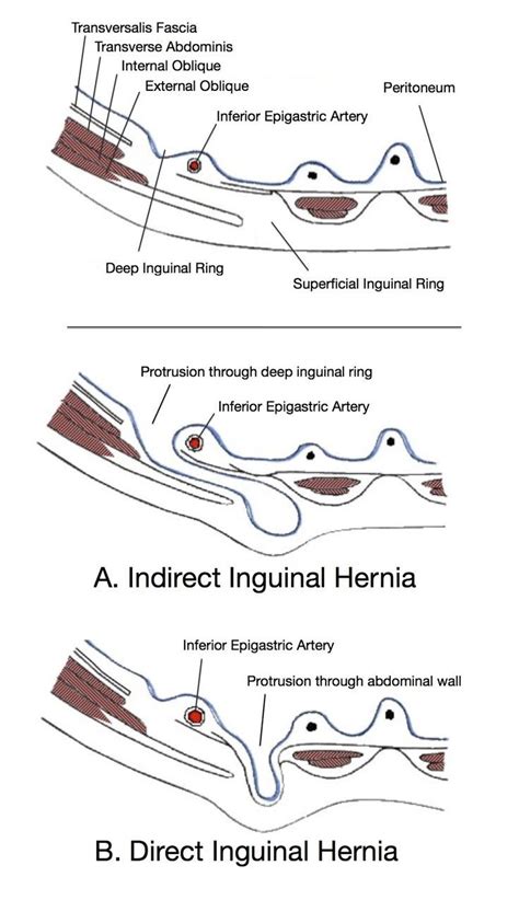 Anatomy Of The Inguinal Region Anatomy