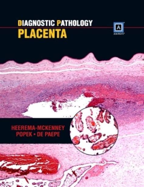 Diagnostic Pathology Placenta 9781937242220 Amy Heerema Mckenney