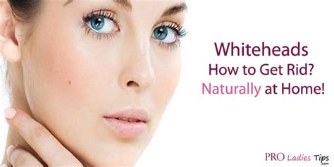 10 Quick And Natural Ways To Remove Whiteheads A Best Fashion
