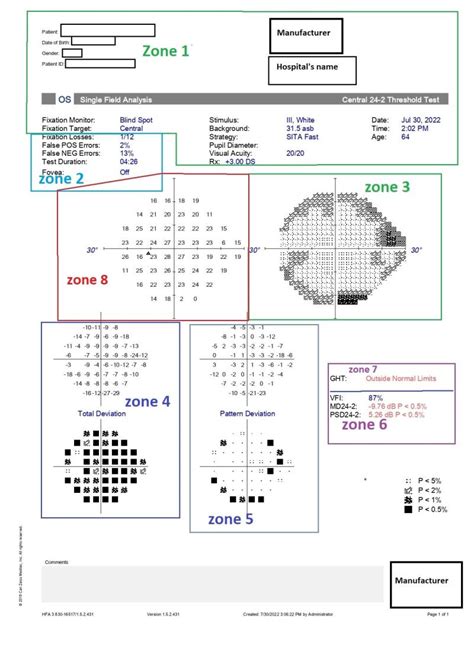 Figure Humphrey Visual Field Printout 24 2 Test With Zones