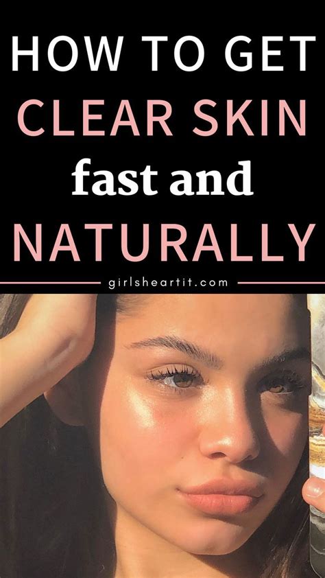 How To Get Clear Skin Fast And Naturally Clear Skin Fast Clear Skin