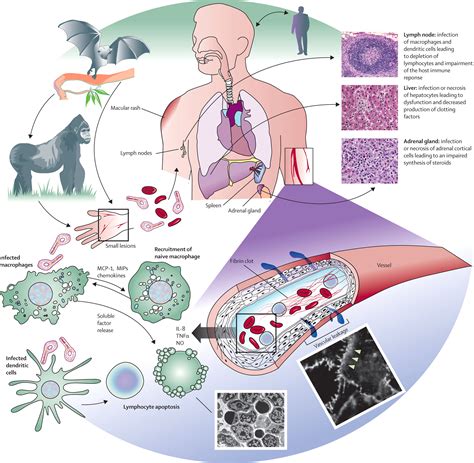 Cardiovascular and Pulmonary Impact of the Ebola Virus: A Review of