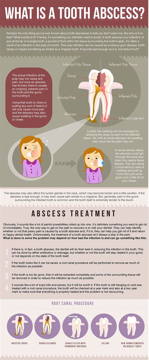 What Is A Tooth Abscess Teeth Infographic Health And Wellness
