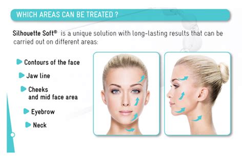 Dr Rachel Ho Silhouette Soft Face Threadlift