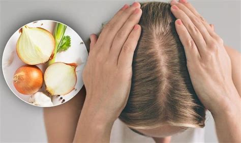 Hair Loss Treatment The Simple Onion Juice Home Remedy To Boost Hair