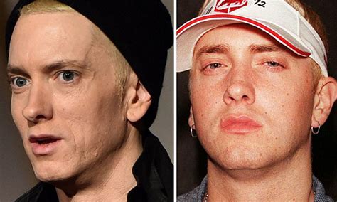 Eminem Before And After Plastic Surgery