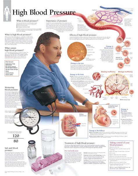 High blood pressure