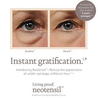 Bags under the eyes occur when weakened and sagging skin relaxes, forming a pouch. This product is AMAZING - immediate improvement (full ...