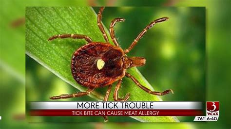 Tick Bites Lead To Allergic Reaction To Meat