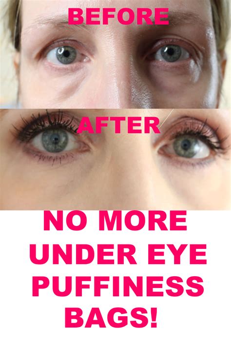 How To Get Rid Of Under Eye Puffiness And Bags Anne P Makeup And More In 2021 Under Eye
