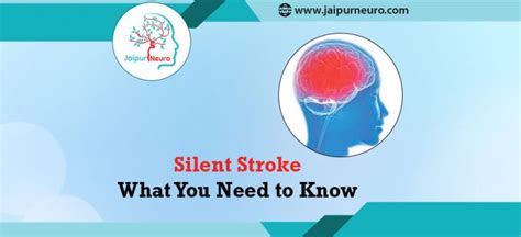 Silent Stroke What You Need To Know About It
