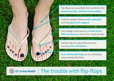 The Trouble With Your Flip Flops Uci Health Orange County Ca
