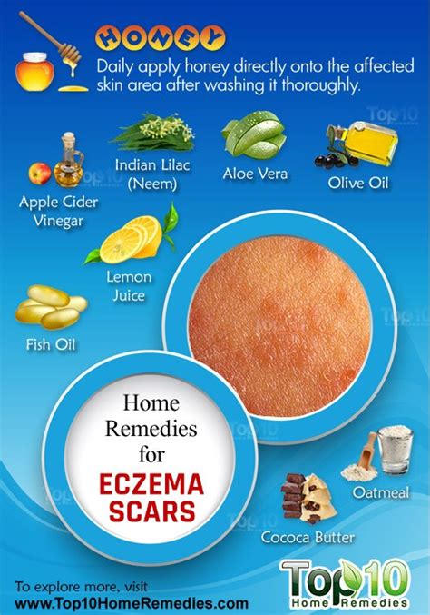 They can dry out your skin. Home Remedies for Eczema Scars | Top 10 Home Remedies