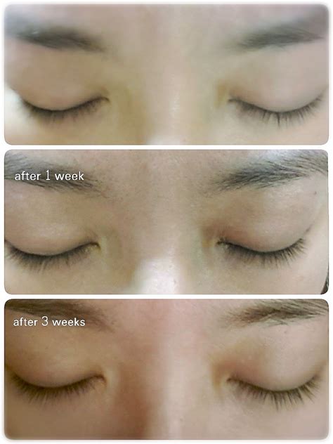 Find out here what is a hair serum, its usage and its benefits. ~SHISEIDO PROFESSIONAL ADENOVITAL EYELASH SERUM