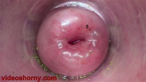 Extreme Female Inserting Nettles Into Cervix And Rod