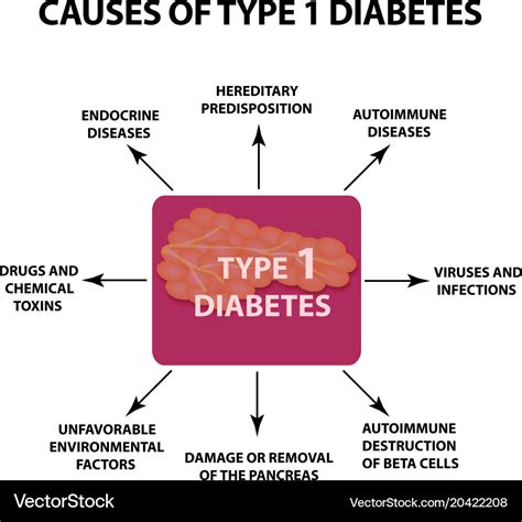 Causes Of Diabetes Type Infographics Royalty Free Vector