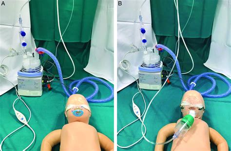 Incorporating A Nebulizer System Into High Flow Nasal Cannula Improves