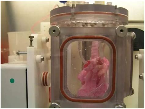 Scientists Transplanted Lab Grown Lungs Into Pigs Are Humans Next